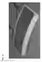 Fig. 03 - Method and coils for human whole-body imaging at 7 T
