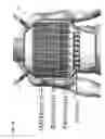 Fig. 04 - Method and coils for human whole-body imaging at 7 T