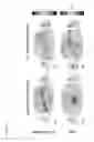 Fig. 05 - Method and coils for human whole-body imaging at 7 T