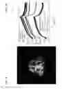 Fig. 14 - Method and coils for human whole-body imaging at 7 T
