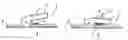Fig. 01 - OPERATING ELEMENT FOR ACTUATION BY A USER AND OPERATING ELEMENT MODULE