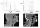 Fig. 01 - Automated contrast enhancement for contouring
