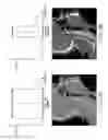 Fig. 04 - Automated contrast enhancement for contouring