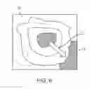 Fig. 07 - METHOD AND DEVICE FOR EXAMINING OR IMAGING AN INTERIOR SURFACE OF A CAVITY