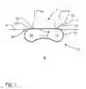 Fig. 02 - Document conveying device for use in a scanner or the like