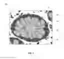 Fig. 02 - Systems and methods for digital image analysis