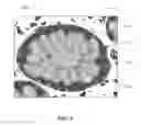 Fig. 02 - Systems and methods for segmenting digital images