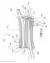 Fig. 10 - Splice tube with wedge retaining caps
