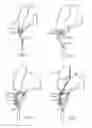 Fig. 07 - Harnessing Flowing Fluids to Create Torque