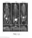 Fig. 12 - PRETARGETING KIT, METHOD AND AGENTS USED THEREIN