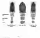 Fig. 08 - Methods of treating an overweight or obese subject