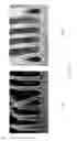 Fig. 13 - Methods of producing structures using a developer-soluble layer with multilayer technology