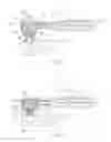 Fig. 05 - Combination rotating dental cleaning brush and paste device