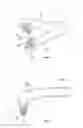 Fig. 02 - DENTAL CLEANING DEVICE