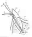 Fig. 01 - Apparatus for evacuation of root canal