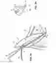 Fig. 04 - Apparatus for evacuation of root canal