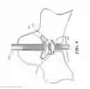 Fig. 09 - Physiological simulator for use as a brachial plexus nerve block trainer