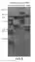 Fig. 08 - Isolated plant deoxyhypusine synthase and nucleotides encoding same