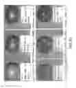 Fig. 35 - Isolated plant deoxyhypusine synthase and nucleotides encoding same