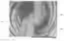 Fig. 01 - Fusible bicomponent spandex