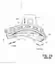 Fig. 04 - Blade tensioner with spring retaining features