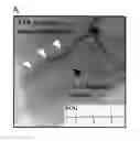 Fig. 01 - Therapeutic Application of Adiponectin in Patients with Acute Myocardial Infarction