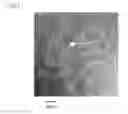 Fig. 06 - Neuronal differentiation-inducing peptide and use thereof