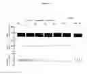 Fig. 08 - COMPOSITIONS, METHODS, AND DEVICES FOR THE TREATMENT OF DYSMENORRHEA