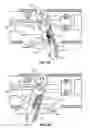 Fig. 07 - Ablation device with articulated imaging transducer
