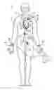 Fig. 01 - Wireless cardiac pulsatility sensing