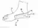 Fig. 01 - Arch strap for treating heel pain