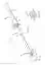 Fig. 09 - Magnetically guided catheters