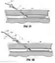 Fig. 04 - SYSTEM AND METHOD FOR ESTABLISHING VASCULAR ACCESS