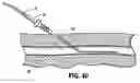 Fig. 08 - SYSTEM AND METHOD FOR ESTABLISHING VASCULAR ACCESS