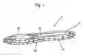 Fig. 02 - FEMININE HYGIENE APPARATUS AND METHOD