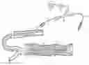 Fig. 01 - Infusion catheter and method