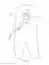 Fig. 02 - Pericardial devices, systems and methods for occluding an atrial appendage