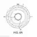 Fig. 08 - Rotational atherectomy device with eccentric abrasive element and method of use