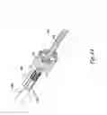 Fig. 09 - Vessel occluding material extractor
