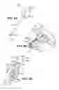 Fig. 04 - Apparatuses and methods for forming incisions in ocular tissue