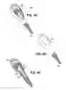 Fig. 09 - Apparatuses and methods for forming incisions in ocular tissue