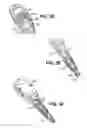 Fig. 10 - Apparatuses and methods for forming incisions in ocular tissue