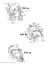 Fig. 12 - Apparatuses and methods for forming incisions in ocular tissue