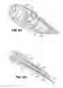 Fig. 16 - Apparatuses and methods for forming incisions in ocular tissue