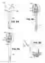 Fig. 21 - Apparatuses and methods for forming incisions in ocular tissue