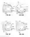 Fig. 22 - Apparatuses and methods for forming incisions in ocular tissue