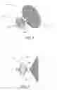 Fig. 02 - Method of implanting an adjustable occlusion device