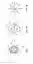 Fig. 05 - Method of implanting an adjustable occlusion device