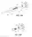 Fig. 12 - Method of implanting an adjustable occlusion device