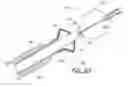 Fig. 13 - Method of implanting an adjustable occlusion device